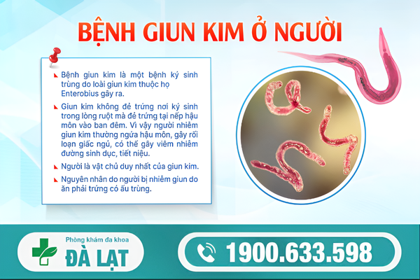 Hình ảnh minh họa
